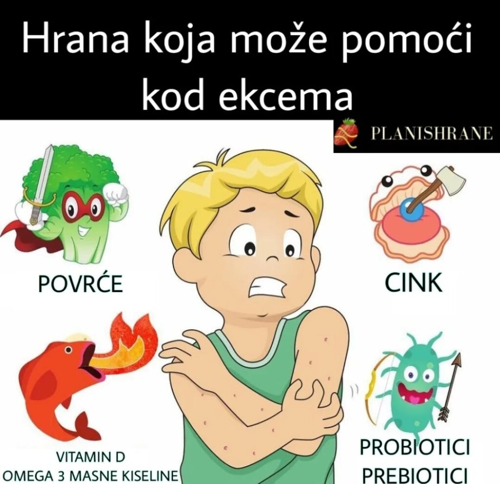 Ekcem i ishrana